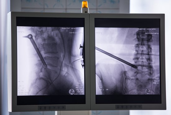 Пациенту поставили имплант, который был изготовлен по индивидуальному заказу. Фото: Владимир Мартьянов