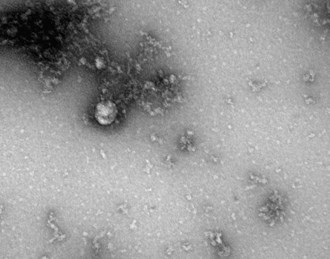 Опубликовано изображение "британского" штамма коронавируса. Фото: пресс-служба Роспотребнадзора.
