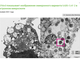 Микрофотография с большим увеличением показывает агрегаты вирусных частиц с шипами в форме короны на их поверхности. Фото: скрин с сайта Университета Гонконга
