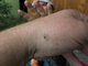Этим летом комары в Свердловской области действительно встречаются не так часто. Фото: Алексей Кунилов