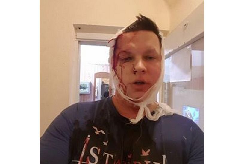 Святослав Штукин сейчас находится в больнице. Его опросили, проводится доследственная проверка. Фото: Евгений Боровик / facebook